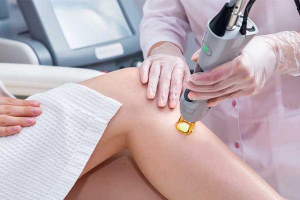 Laser Hair Removal