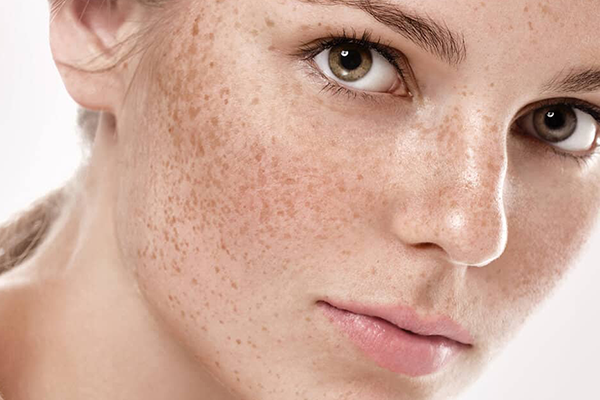 Spot Treatment
